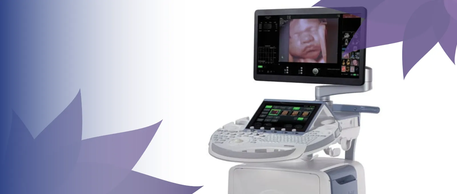 ultrasound imaging