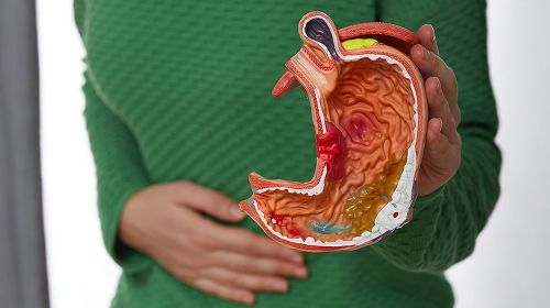 Acidic Stomach | Petals Health