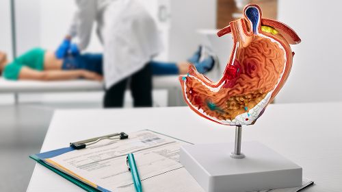 Acid Reflux (GERD) | Petals Health