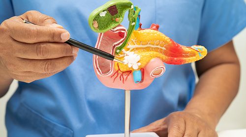 Pancreatitis | Petals Health