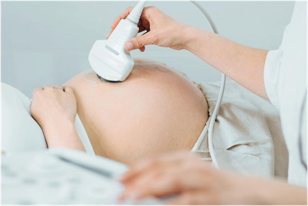 What is a Fetal Doppler?