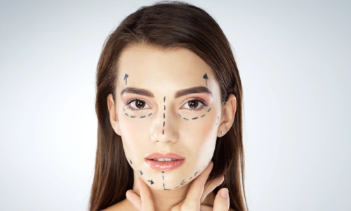 Facial Contouring, Petals Health Facial Contouring, Petals Health