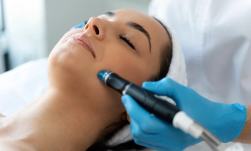 Microneedling (Face & Body), Petals Health Microneedling (Face & Body), Petals Health
