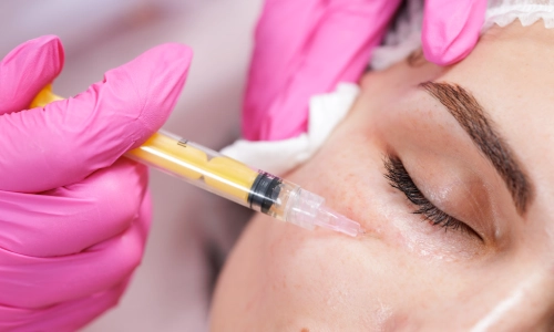 PRP Therapy (Face), Petals Health PRP Therapy (Face), Petals Health