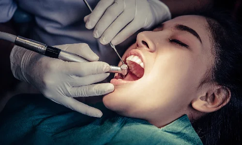 Laser Vaginal Rejuvenation, Petals Health